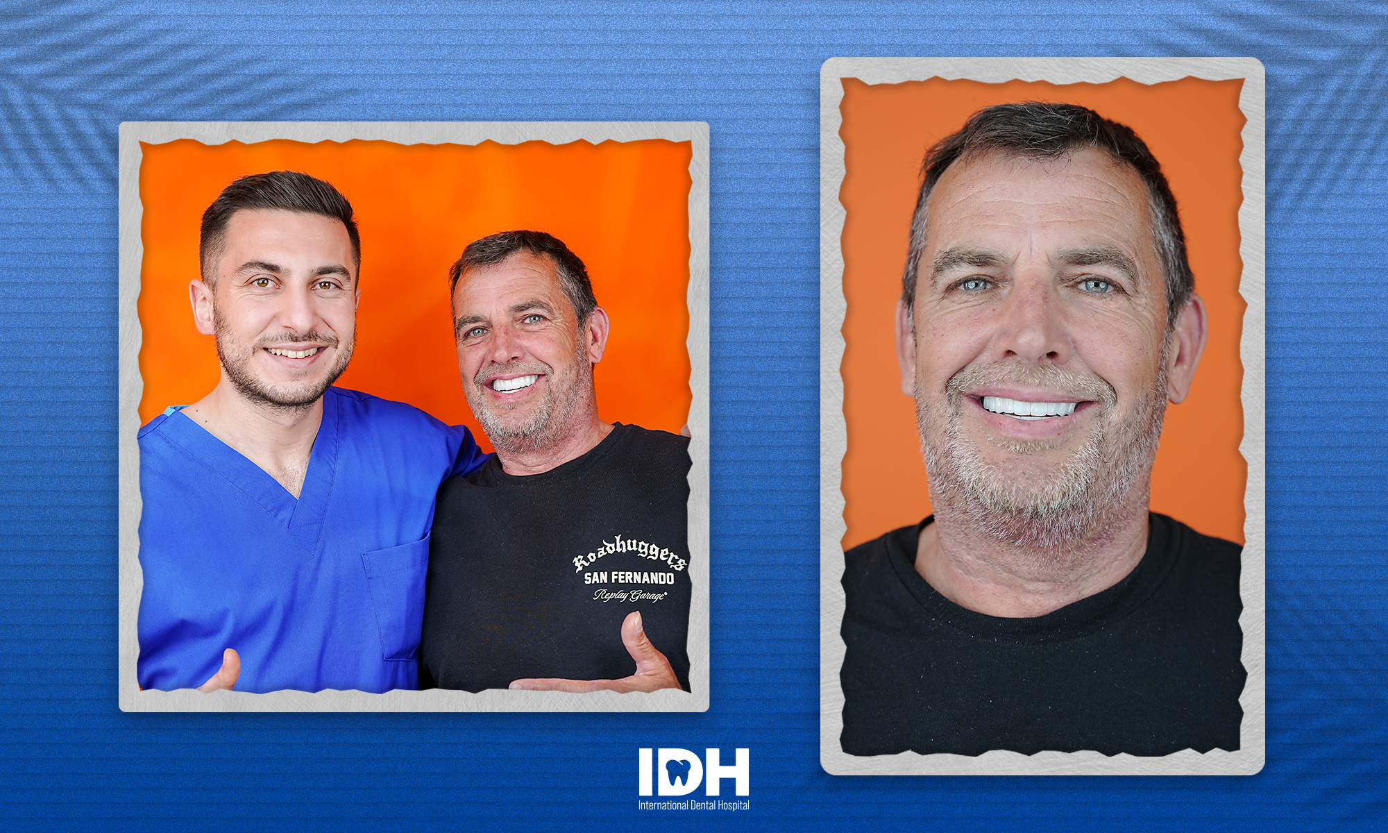 happy-patient-idh-smile-antalya-1