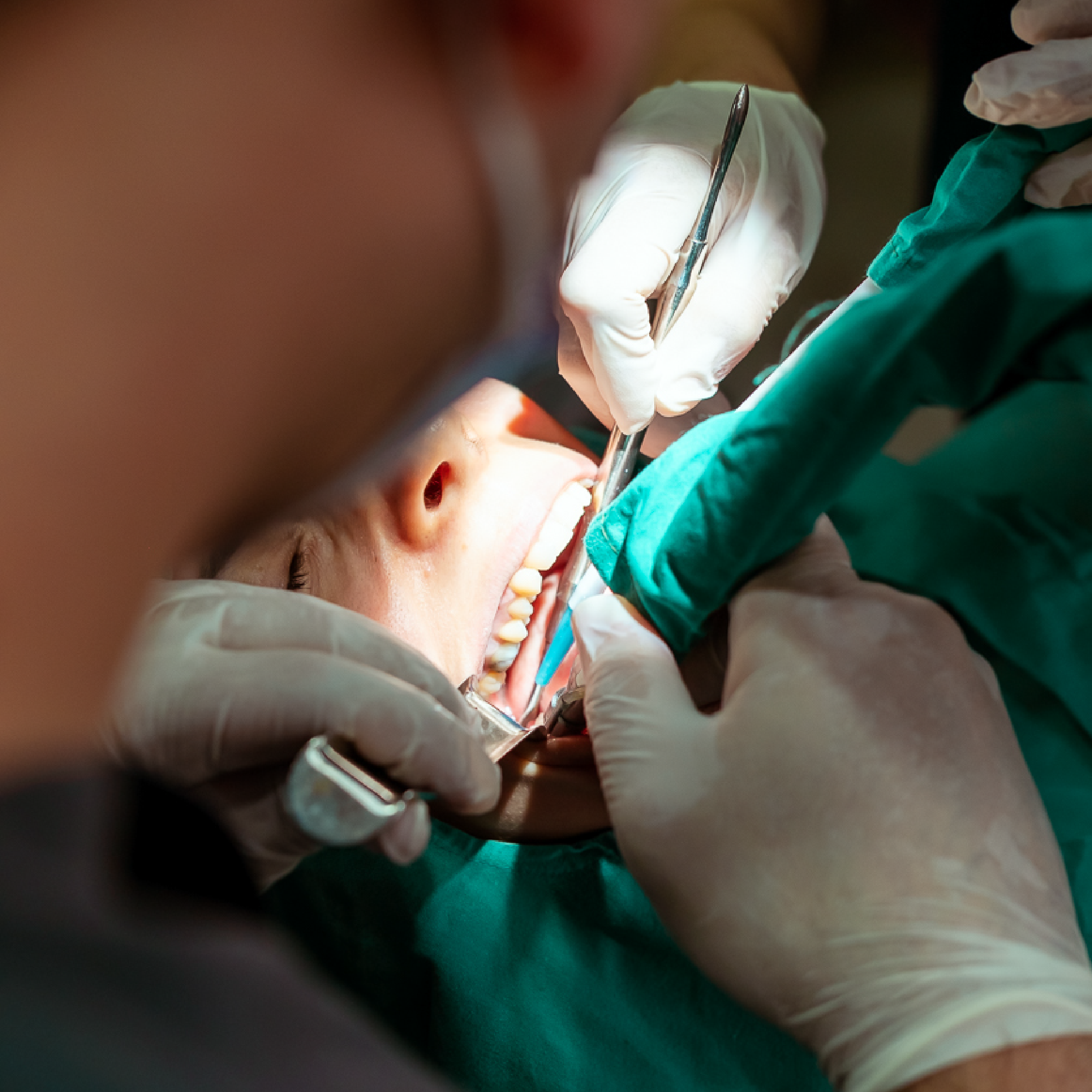 international-dental-hospital-antalya-gallery-9
